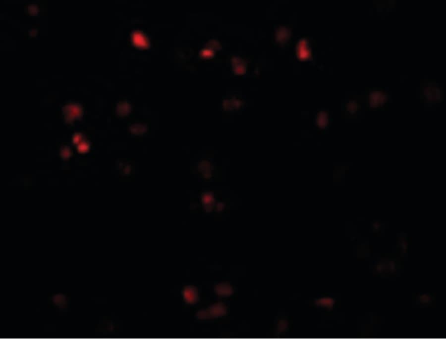 IHC-plus™ ZEB2 / SIP-1 Antibody