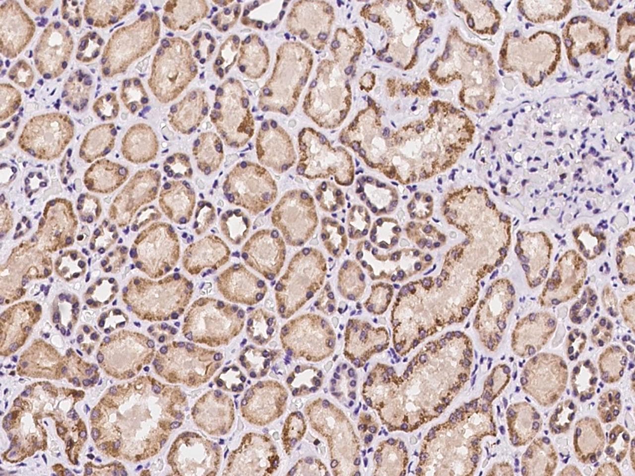 Polyclonal Rabbit anti-Human SPICE1 / CCDC52 Antibody (IHC)