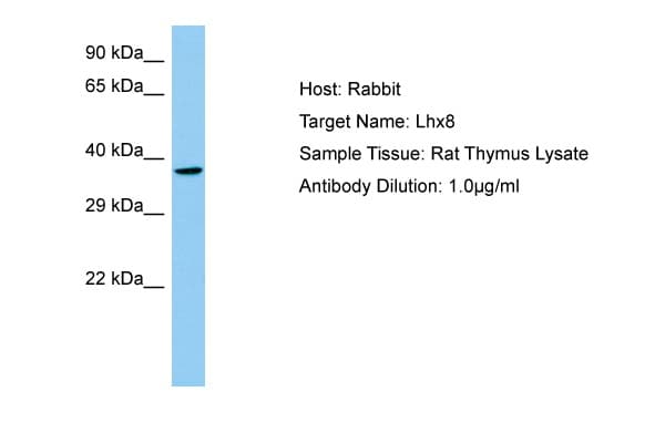 LHX8 Antibody (N-Terminus)