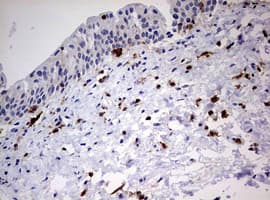 Monoclonal Mouse anti-Human DOCK2 Antibody (clone OTI7G2, aa1544-1830, IHC, WB)