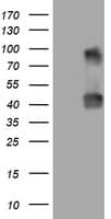 Monoclonal Mouse anti-Human NEU1 / NEU Antibody (clone OTI3D4, IHC, WB)