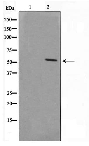 Polyclonal Rabbit anti-Human SMAD1+5+9 Antibody (WB)
