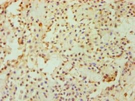 DKK4 Antibody (aa19-224)