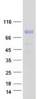 Human SERPING1 / C1 Inhibitor Protein (Recombinant Myc-DDK (Flag))