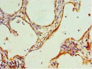 HMGN4 Antibody (aa1-90)