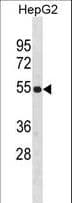 ZNF101 Antibody (aa122-148)