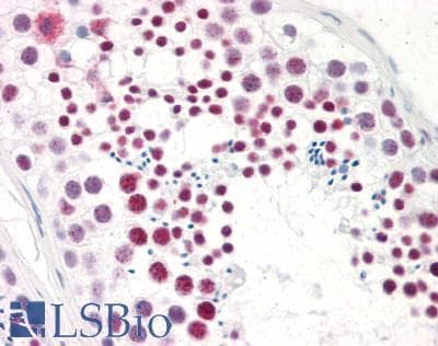 IHC-plus™ Polyclonal Rabbit anti-Human SARNP / Hcc-1 / CIP29 Antibody (aa4-210, IHC, IF, WB)