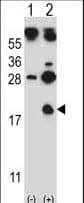 Polyclonal Rabbit anti-Human HBG1 / Fetal Hemoglobin Antibody (aa56-85, WB)