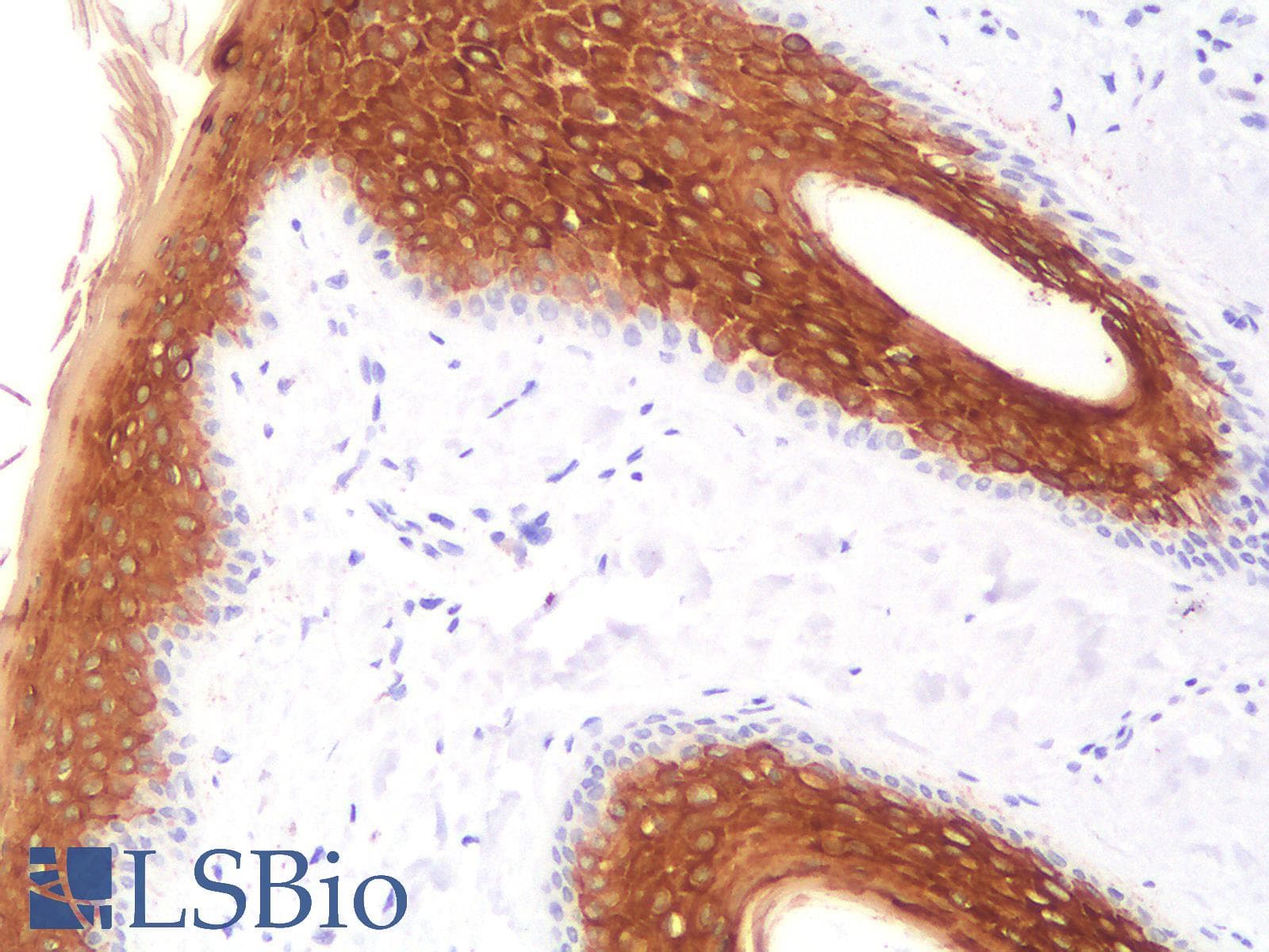 PathPlus™ KRT10 / CK10 / Cytokeratin 10 Antibody (clone KRT10/1990R)