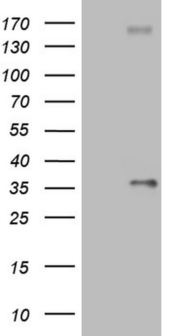 PROCR / EPCR Antibody (aa1-210, clone OTI2D11)