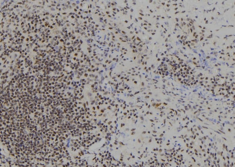 BACH1 Antibody