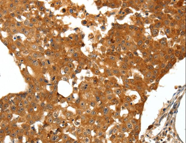 Polyclonal Rabbit anti-Human SSTR1 Antibody (IHC)
