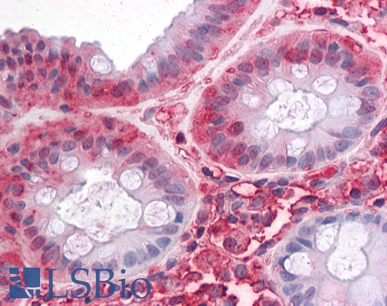 IHC-plus™ SLC1A5 / ASCT2 Antibody (Internal)