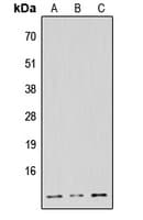 NDUFB1 / MNLL Antibody (N-Terminus)
