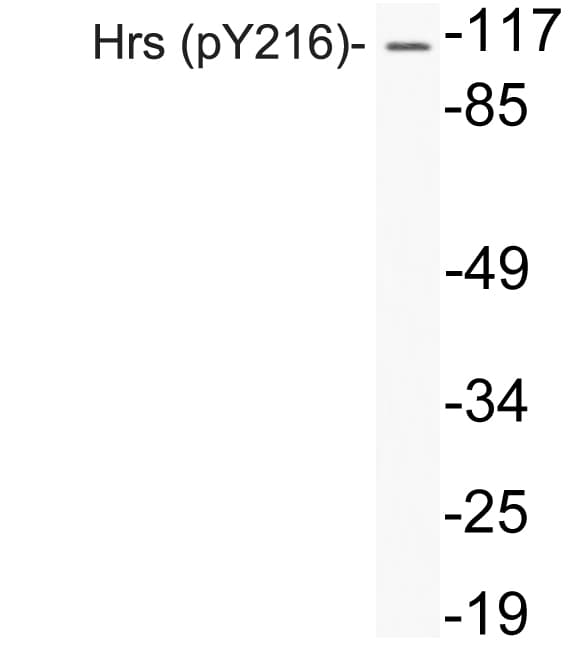 HRS / HGS Antibody (phospho-Tyr216)