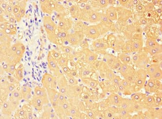 TBC1D7 Antibody
