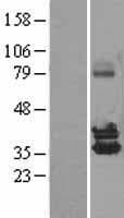 NUDT6 Protein (Over-Expression Lysate Myc-DDK (Flag))