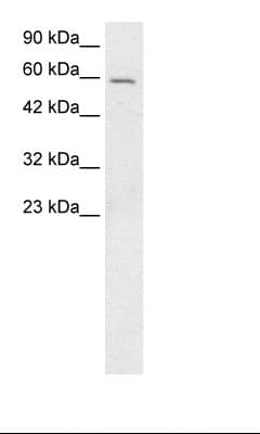 Polyclonal Rabbit anti-Human BF1 / FOXG1 Antibody (aa139-169, IHC, WB)