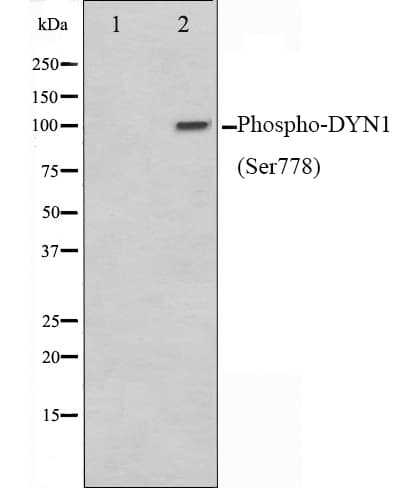 Polyclonal Rabbit anti-Human DNM1 / Dynamin Antibody (phospho-Ser778, WB)
