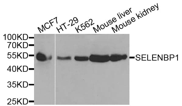 Selenium Binding Protein 1 Antibody