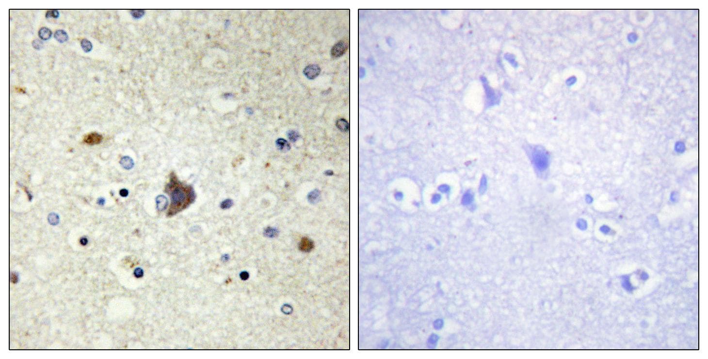 COL4A3 / Tumstatin Antibody