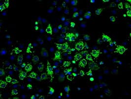 HSD17B10 / HADH2 Antibody (clone OTI10B4)