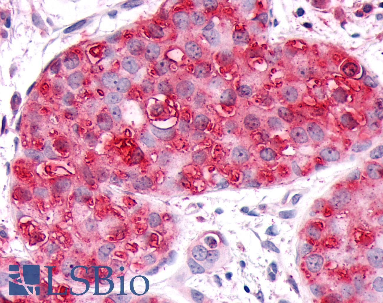 PathPlus™ GPR63 Antibody (C-Terminus)