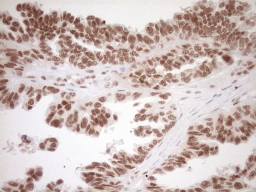 NR1H3 / LXR Alpha Antibody (aa69-329, clone OTI1A5)