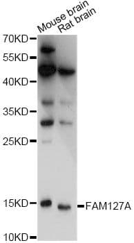 Polyclonal Rabbit anti-Human FAM127A Antibody (WB)