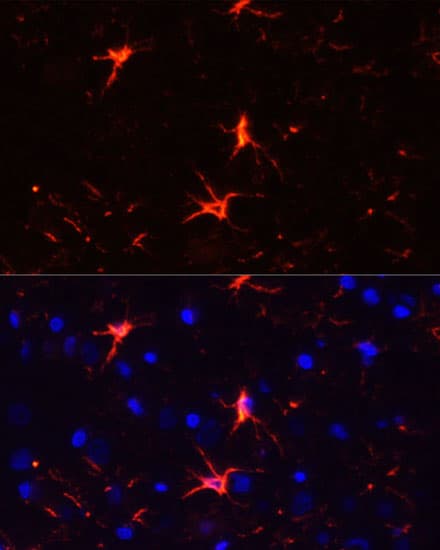 GFAP Antibody