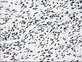 TYRO3 Antibody (clone OTI2C4)