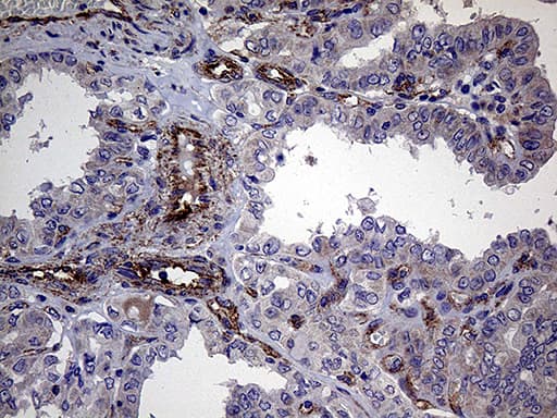 TYW2 / TRMT12 Antibody (clone OTI1C9)