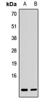 Polyclonal Rabbit anti-Human BET1L / GS15 Antibody (WB)