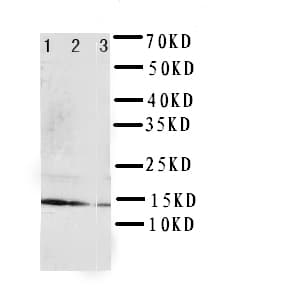 Polyclonal Rabbit anti-Human IL4 Antibody (aa72-88, IHC, WB)