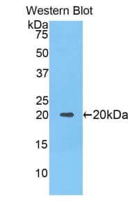 NOS2 / iNOS Antibody (aa533-696)