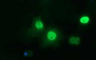 TP73 / p73 Antibody (aa167-409, clone OTI1B5)