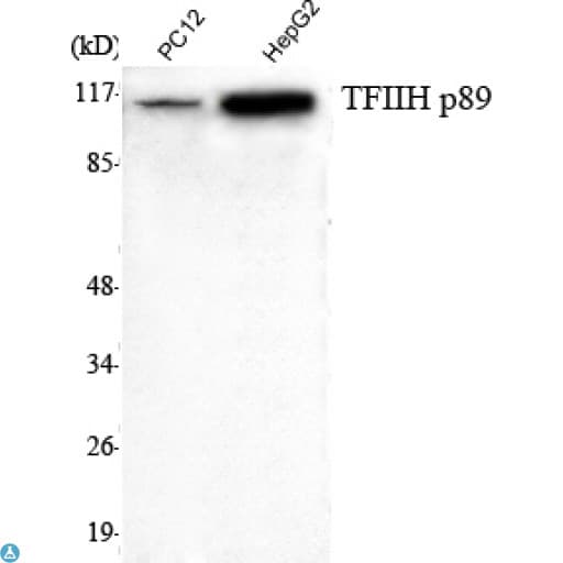 ERCC3 / XPB Antibody