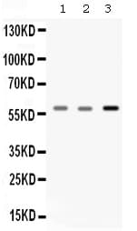 CAT / Catalase Antibody