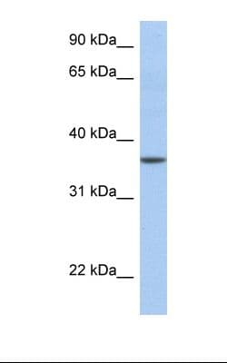 Polyclonal Rabbit anti-Human LFNG / Lunatic Fringe Antibody (aa74-123, IHC, WB)