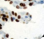 NKX2-1 / Thyroid-Specific TF Antibody (clone 8G7G3/1)