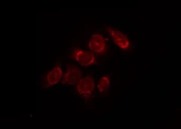 IHC-plus™ VDAC2 Antibody