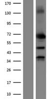 MMP2 Protein (Over-Expression Lysate Myc-DDK (Flag))