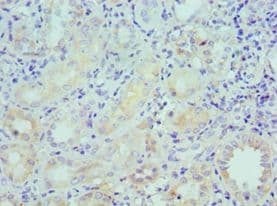 LRP6 Antibody (aa20-150)