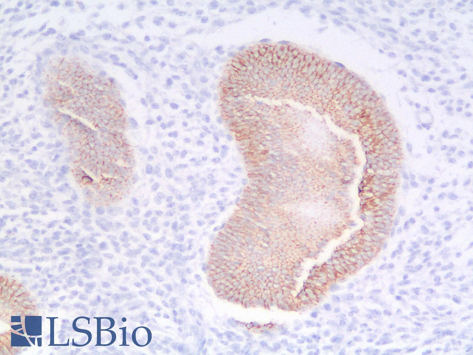 IHC-plus™ Recombinant Monoclonal Rabbit anti-Human CDH1 / E Cadherin Antibody (clone CDH1/2208R, IHC, IF, WB)
