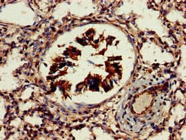 Polyclonal Rabbit anti-Human AKT1S1 / PRAS40 Antibody (IHC, WB)