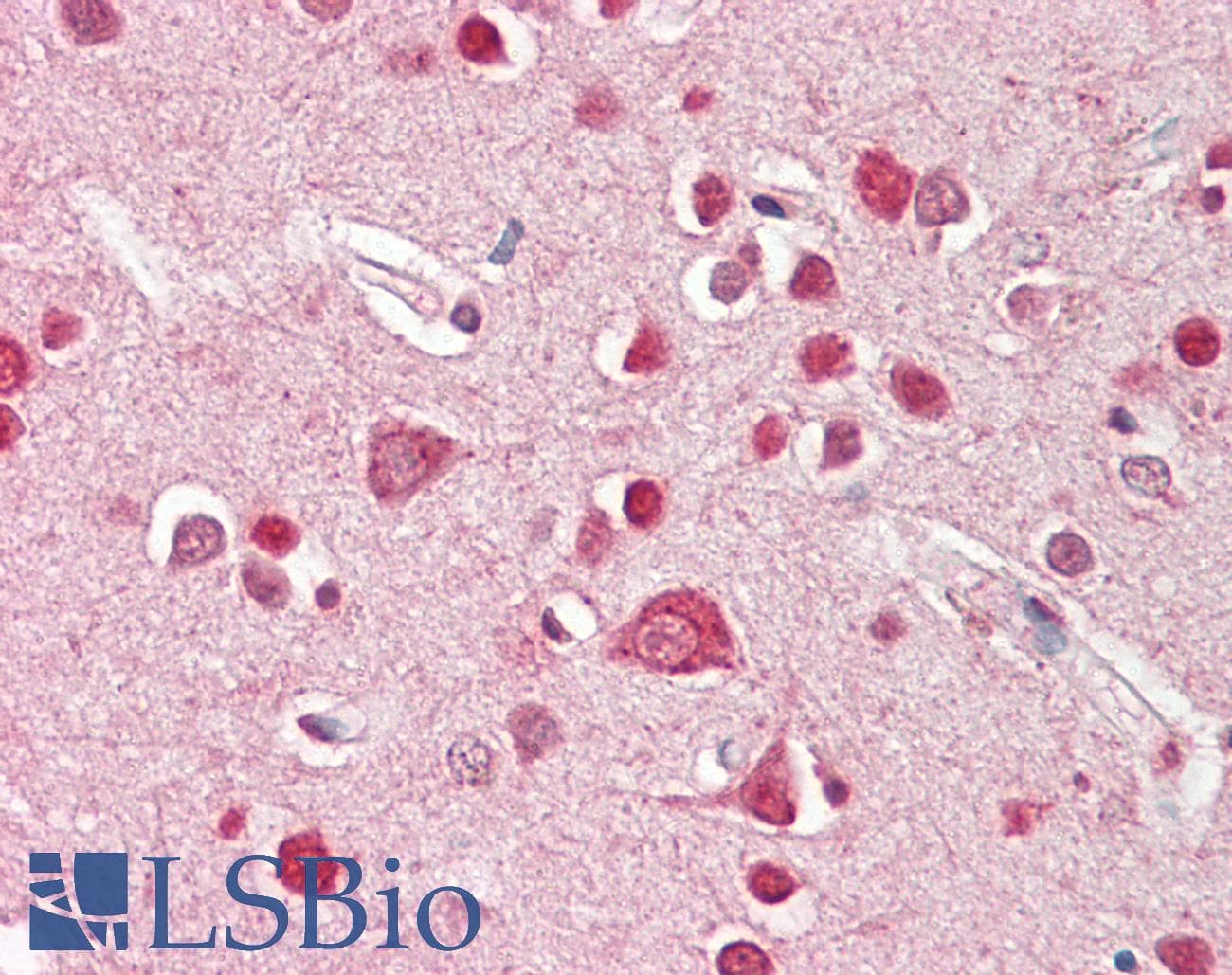 IHC-plus™ STK39 / SPAK Antibody (aa401-414)