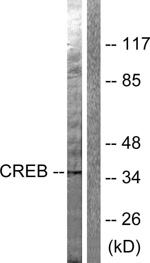 CREB1 / CREB Antibody (p142)