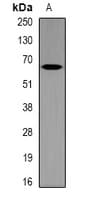 Polyclonal Rabbit anti-Mouse MT-ND5 Antibody (WB)