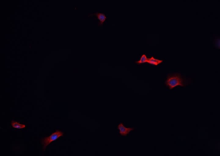 DMTN / Dematin Antibody (phospho-Ser403)