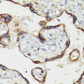 TNFSF11 / RANKL / TRANCE Antibody